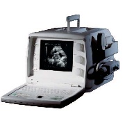 SonoAce 600 hordozható fekete-fehér ultrahang készülék