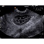 SonoVet R3 hordozható állatorvosi ultrahang kép 2