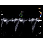 Cardiovascularis ultrahang - Accuvix A30
